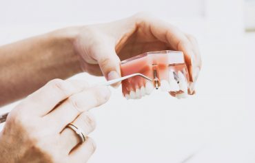Dental Implants in Lake Mary, FL