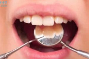 Choose Dentist of Lake Mary as your Children’s Pediatric Dentist