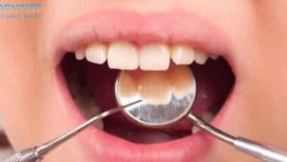 Choose Dentist of Lake Mary as your Children’s Pediatric Dentist