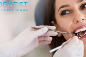 What You Should Know About Teeth Whitening in Lake Mary