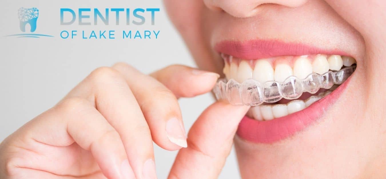 The Full Benefits of an Invisalign Dentist