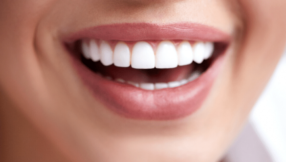 Professional Services for Teeth Whitening in Lake Mary